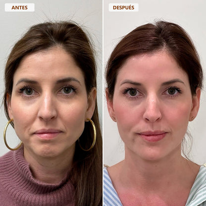 Cepillo drenaje linfático - ENAYAJ