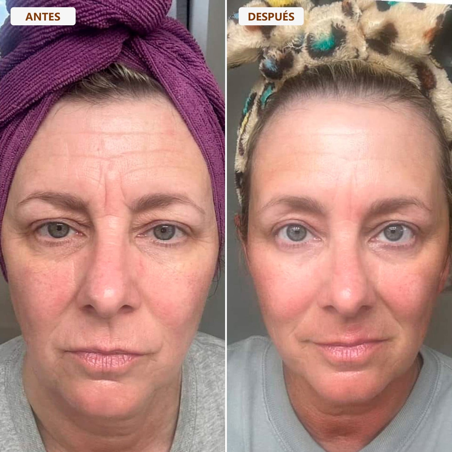 Cepillo drenaje linfático - ENAYAJ