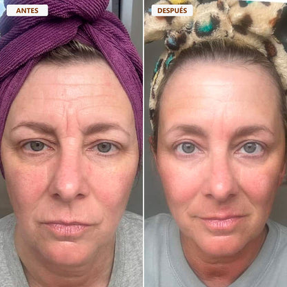 Cepillo drenaje linfático - ENAYAJ