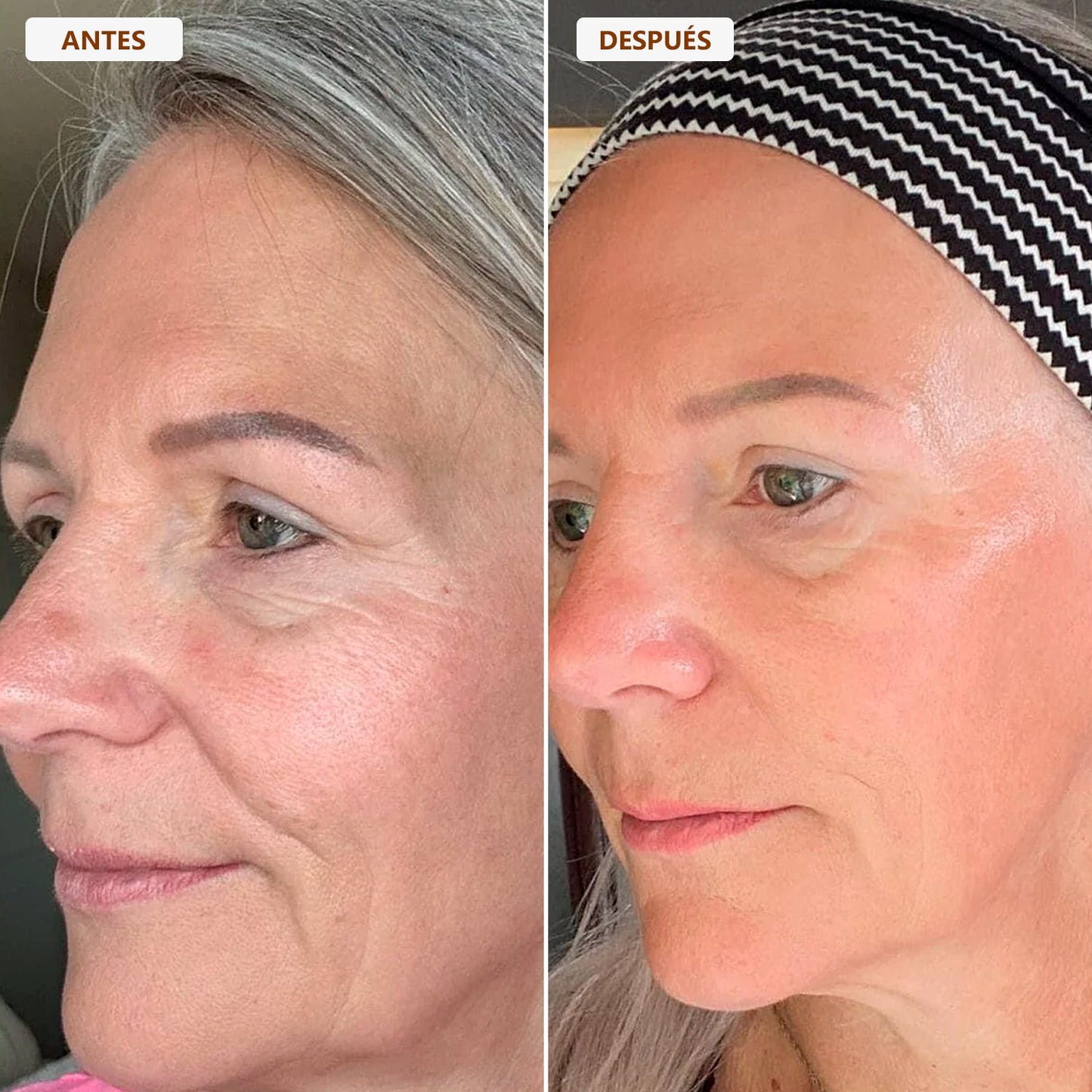 Cepillo drenaje linfático - ENAYAJ