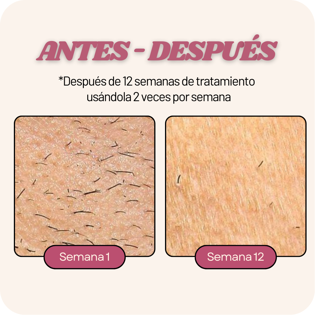 Depiladora PRO