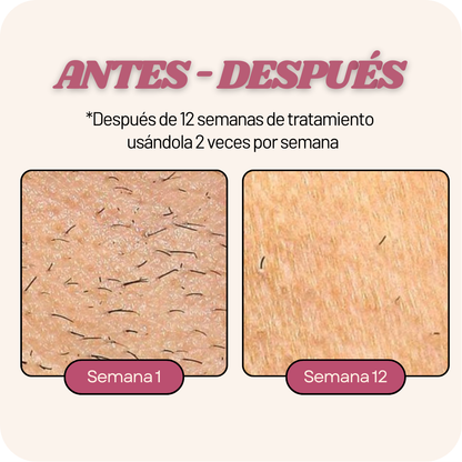 Depiladora PRO